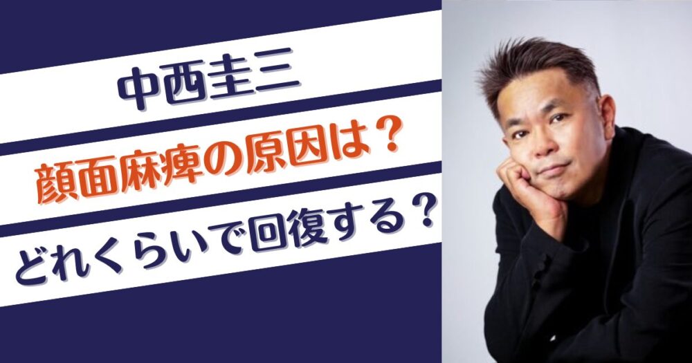 中西圭三の顔面神経麻痺の原因はウイルス感染？どれくらいで回復する？